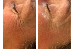 02 Before & Afters