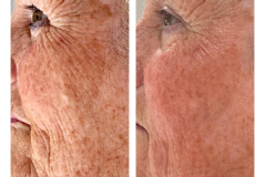 01 Before & Afters - 2