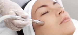 Microdermabrasion at The Beauty Rooms Chelmsford
