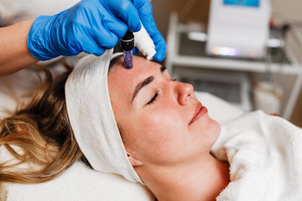 Microneedling