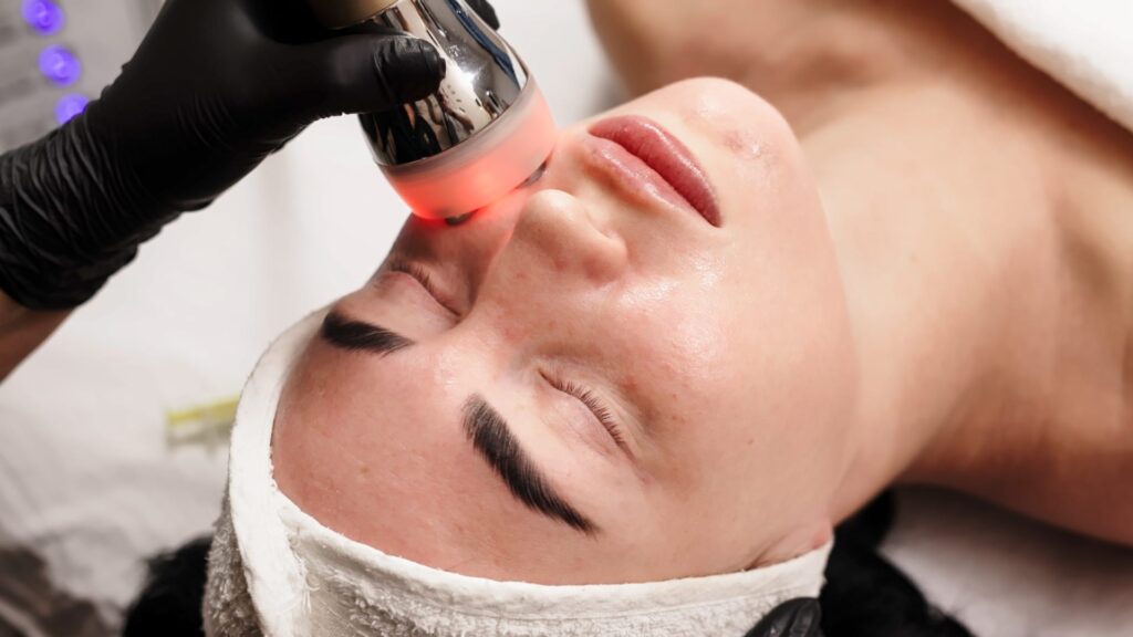 Radio Frequency treatment